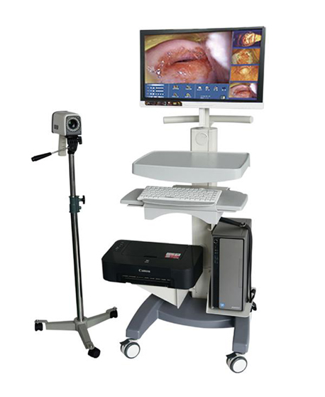 Colposcope image processing system PK-6650 (HD)